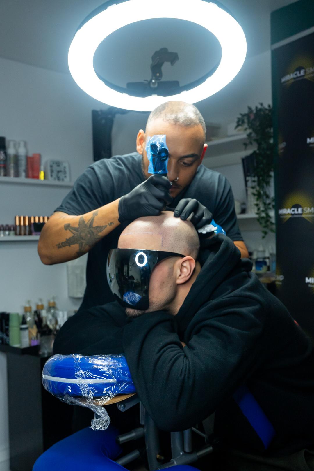 Hairline Restoration
